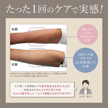 茨城県つくばみらい市のふるさと納税 LINKA エピゼロ（IPL光脱毛器） LINKA リンカ 美顔器 美白 美容 スキンケア 美容家電 エステ 脱毛器 脱毛 光美容 フォトフェイシャル [EV06-NT]