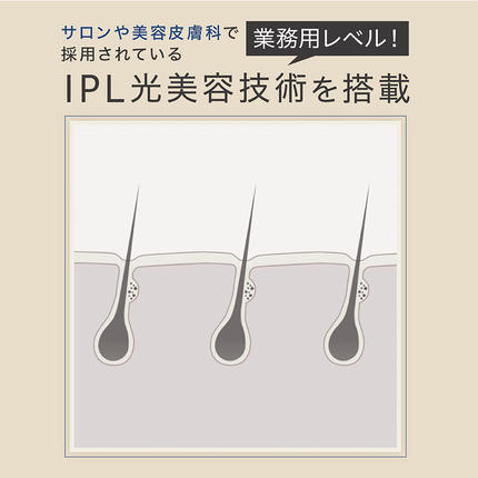 茨城県つくばみらい市のふるさと納税 LINKA エピゼロ（IPL光脱毛器） LINKA リンカ 美顔器 美白 美容 スキンケア 美容家電 エステ 脱毛器 脱毛 光美容 フォトフェイシャル [EV06-NT]